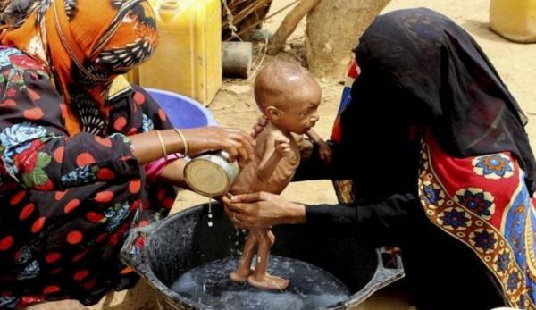 منظمة دولية: 81% من اليمنيين يعيشون في فقر مدقع "و يجب إنهاء الصراع
